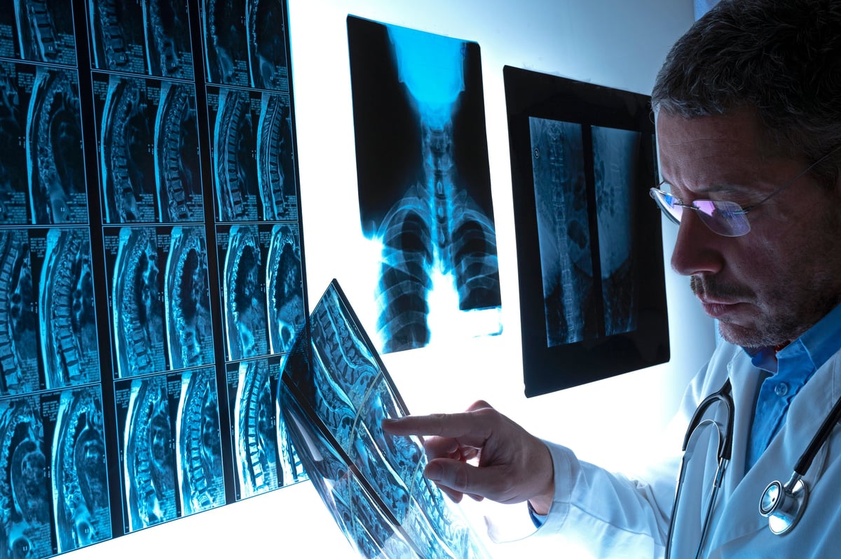 Radiografía y resonancia magnética de columna lumbar evaluadas para planificar la cirugía de columna en pacientes con obesidad mórbida en CDMX