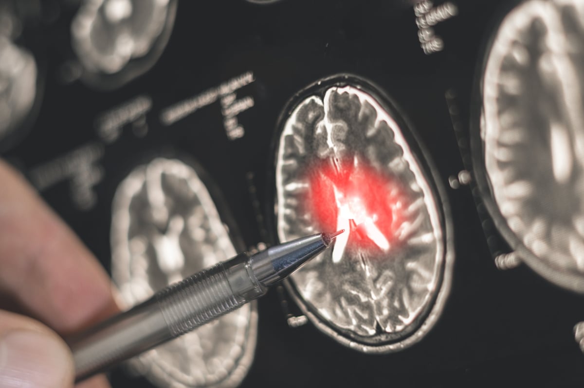 A doctor examines an X-ray medical image