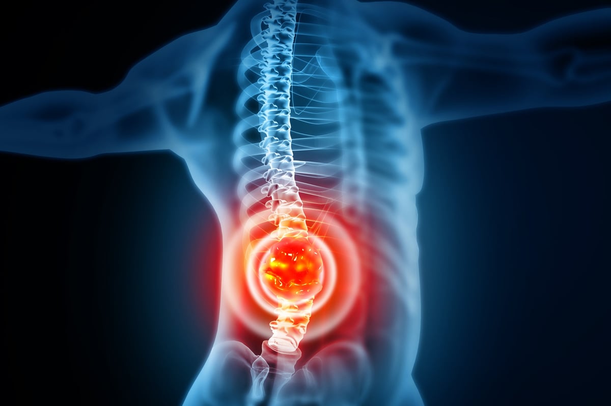 Ilustración tridimensional de la anatomía de la columna vertebral y estructuras nerviosas, utilizada para diferenciar el dolor central de la fibromialgia de la patología estructural de columna