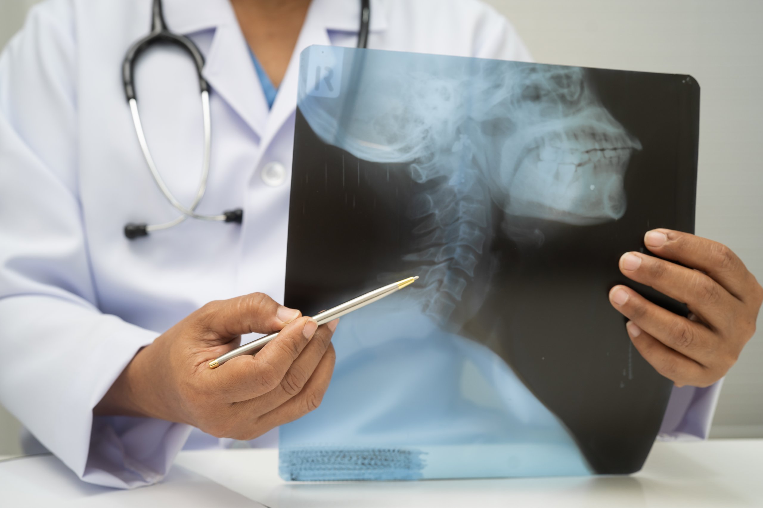 Doctor examinando radiografía de columna cervical para diagnóstico neurológico